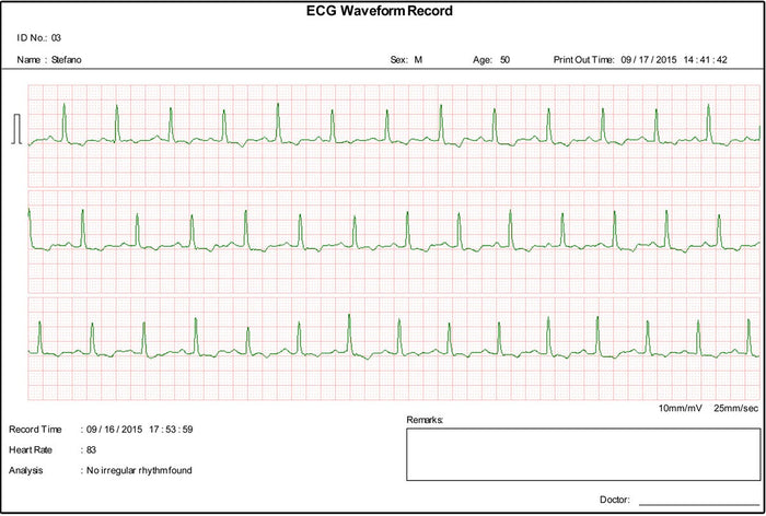 Ecg palmare Cardio B - 1 canale / 17 referti