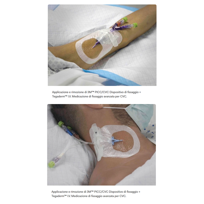 Fissaggio adesivo sterile 3M TEGADERM PICC/CVC cm 8,5 x 11,5 (conf. 20 pz.)